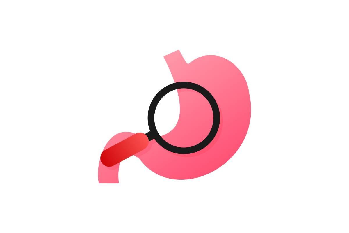 Stomach Endoscopy. Endoscope in Stomach